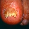 misuse_loprox9-691.jpg