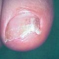 misuse_loprox9-722.jpg