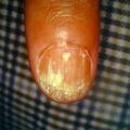 misuse_loprox9-814.jpg