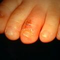 misuse_madecasol9-403.jpg