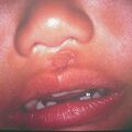misuse_madecasol9-491.jpg