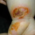 misuse_madecassol010316.jpg