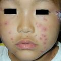 misuse_madecassol010609-1.jpg