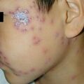 misuse_madecassol010609-2.jpg