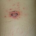 misuse_madecassol010627.jpg