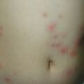 misuse_madecassol010702-1.jpg
