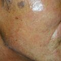 misuse_madecassol010702.jpg