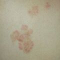 misuse_madecassol010705.jpg