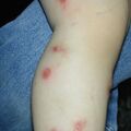 misuse_madecassol010710.jpg