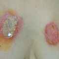 misuse_madecassol010720.jpg