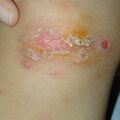 misuse_madecassol010723.jpg