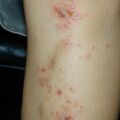 misuse_madecassol010727.jpg
