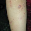 misuse_madecassol010804.jpg