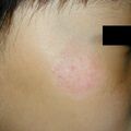 misuse_madecassol010829.jpg