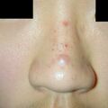 misuse_madecassol020214.jpg