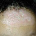 misuse_madecassol020305.jpg
