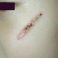 misuse_madecassol020522.jpg