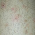misuse_madecassol020701-1.jpg