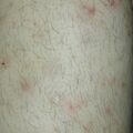 misuse_madecassol020701-2.jpg