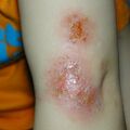 misuse_madecassol020708-1.jpg