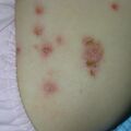 misuse_madecassol020723.jpg