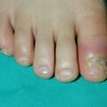 misuse_madecassol020725.jpg