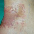 misuse_madecassol020812-1.jpg