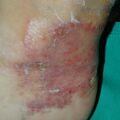 misuse_madecassol020812-2.jpg