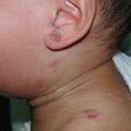 misuse_madecassol020817.jpg