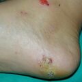 misuse_madecassol020828-1.jpg