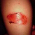 misuse_madecassol2000-266.jpg
