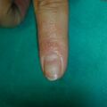 misuse_maxit020722-1.jpg