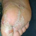 misuse_mentax020423.jpg
