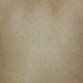 misuse_mentholatum010710.jpg