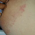misuse_mentholatum020715-1.jpg