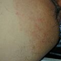 misuse_mentholatum020715-2.jpg
