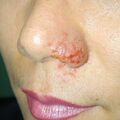 misuse_micosil020528.jpg