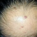 misuse_modaderms020817.jpg