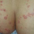 misuse_modaderms020826-1.jpg