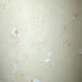 misuse_molluscum010220-2.jpg