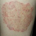misuse_moolpop020722-2.jpg