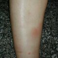 misuse_mulpass020719-2.jpg