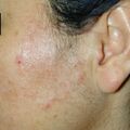misuse_myderm020109.jpg