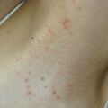 misuse_myderm020420-1.jpg