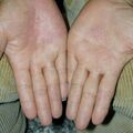 misuse_nadran010413.jpg