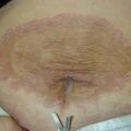 misuse_nobason020218.jpg