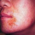misuse_oramedy2000-96.jpg
