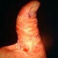 misuse_pas9-450.jpg