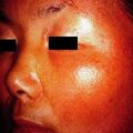 misuse_peeling2000-260.jpg