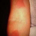 misuse_peeling2000-261.jpg